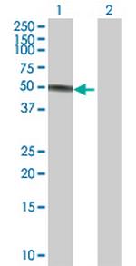 PPHLN1 Antibody in Western Blot (WB)