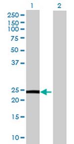 ZNF581 Polyclonal Antibody, MaxPab™