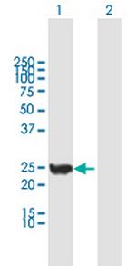 CINP Polyclonal Antibody, MaxPab™