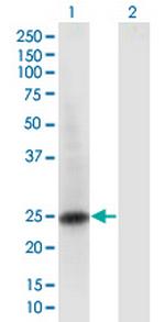 RAB6B Monoclonal Antibody (1A5)