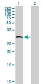 HDAC7A Polyclonal Antibody, MaxPab™