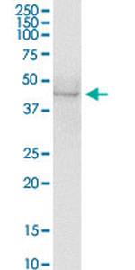 AZIN1 Antibody in Western Blot (WB)