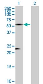 AZIN1 Polyclonal Antibody, MaxPab™