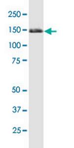 TRIM33 Monoclonal Antibody (6D1)