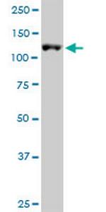 ARS2 Antibody in Western Blot (WB)