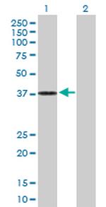 DHRS7 Antibody in Western Blot (WB)