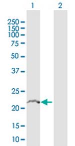 TMBIM4 Antibody in Western Blot (WB)