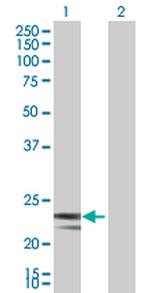 MRPS23 Antibody in Western Blot (WB)