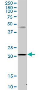 MRPS23 Antibody in Western Blot (WB)