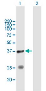 STYXL1 Antibody in Western Blot (WB)