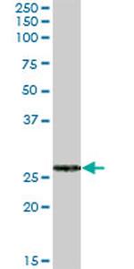FKBP7 Antibody in Western Blot (WB)
