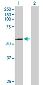 SUFU Antibody in Western Blot (WB)