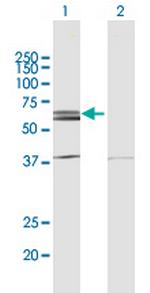 NLK Polyclonal Antibody, MaxPab™