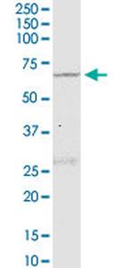 NLK Antibody in Western Blot (WB)