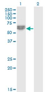 NLK Monoclonal Antibody (2B11)