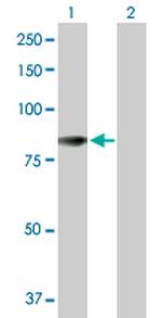 ACSL5 Polyclonal Antibody, MaxPab™