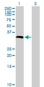 CYB5R1 Antibody in Western Blot (WB)