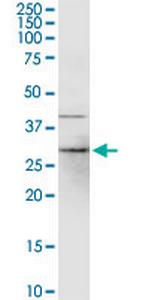 CYB5R1 Polyclonal Antibody, MaxPab™