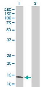 ZNF44 Antibody in Western Blot (WB)