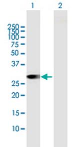 RAB23 Polyclonal Antibody, MaxPab™