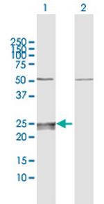 CMPK1 Polyclonal Antibody, MaxPab™