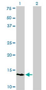 POLR3K Monoclonal Antibody (3F5)