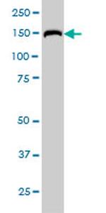 RAPGEF6 Antibody in Western Blot (WB)