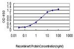 RP6-213H19.1 Antibody in ELISA (ELISA)