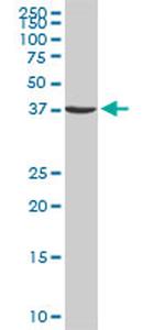 RP6-213H19.1 Antibody in Western Blot (WB)