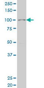 SIX4 Monoclonal Antibody (3B8)
