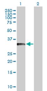 BCL11A Polyclonal Antibody, MaxPab™