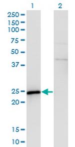 SPA17 Antibody in Western Blot (WB)