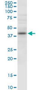 NUDT9 Polyclonal Antibody, MaxPab™