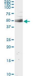 UBASH3A Monoclonal Antibody (4D2)