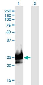 DSCR6 Monoclonal Antibody (1D1)