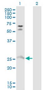 MYO3A Polyclonal Antibody, MaxPab™