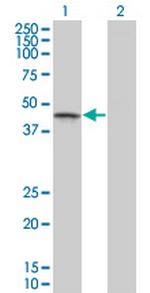 CSNK1G1 Antibody in Western Blot (WB)