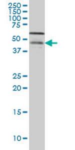 CSNK1G1 Monoclonal Antibody (8A4)