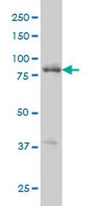 RIPK4 Monoclonal Antibody (2G3)