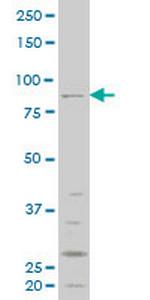 RIPK4 Antibody in Western Blot (WB)