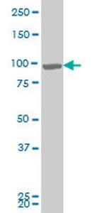 RIPK4 Antibody in Western Blot (WB)