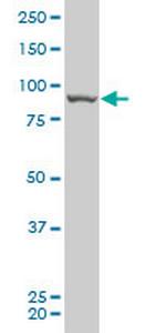 RIPK4 Antibody in Western Blot (WB)