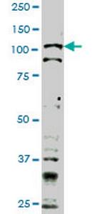TLR9 Monoclonal Antibody (1F4)
