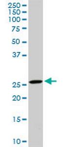 DCUN1D1 Monoclonal Antibody (3D7)
