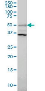 ERRFI1 Monoclonal Antibody (2B9)