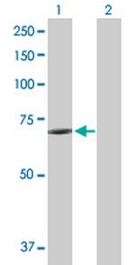 KCNK10 Antibody in Western Blot (WB)