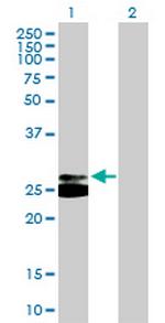 TREM1 Polyclonal Antibody, MaxPab™