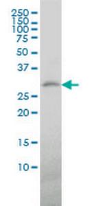 TREM1 Monoclonal Antibody (2E2)