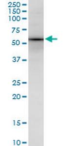 SOX18 Monoclonal Antibody (1C4)