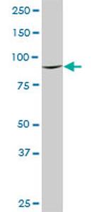 DNAJC10 Antibody in Western Blot (WB)